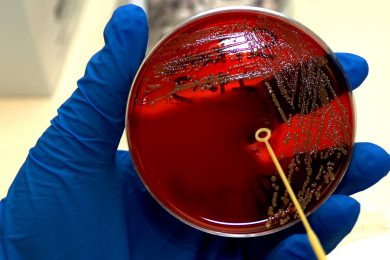 Mold Testing